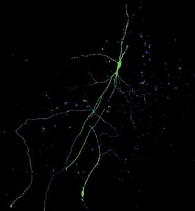 An image of a single dye-filled dopamine neuron, which can be used for assessing the structure of neuronal processes and interrogating the location of incoming synapses via subcellular ChR2-assisted circuit mapping (sCRACM).