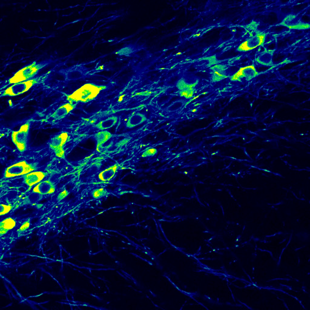 Picture of Dopamine Subcircuits in Reinforcement Learning, Decision-Making, and ...