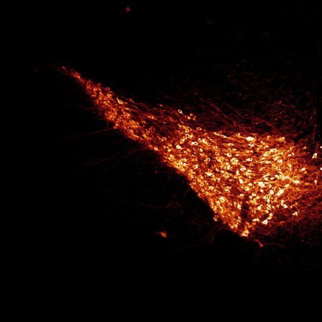 Effects of Stress on Dopamine Circuit Structure and Function