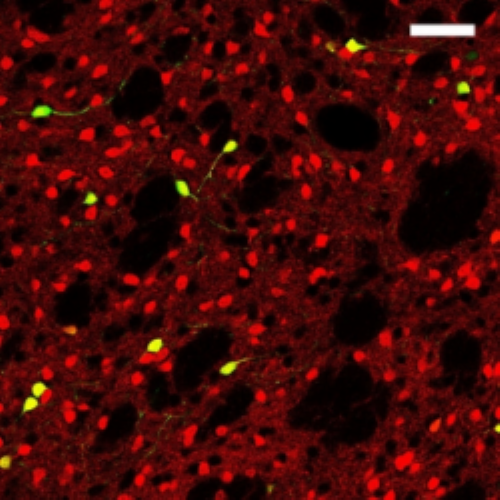 Modified rabies vectors can query whole-brain inputs to specific subsets of midbrain dopamine neurons.