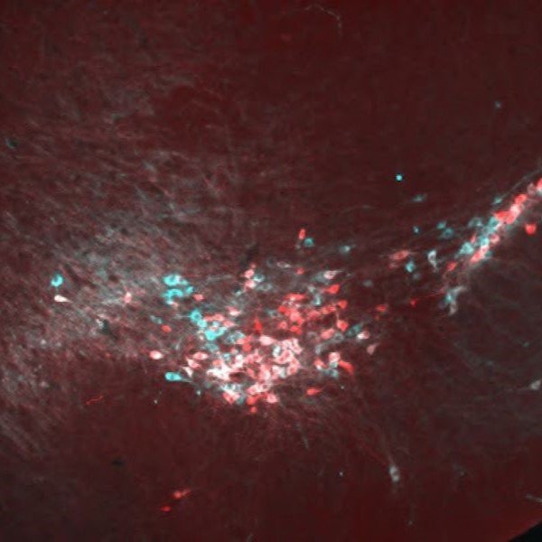 Impacts of Parkinsonian Neuro-degeneration on Dopamine Circuit Structure and Function