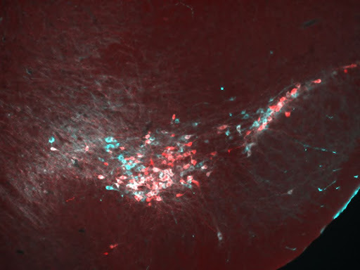 An image of the midbrain showing dopamine neurons labeled via immunostaining for tyrosine hydroxylase (cyan).